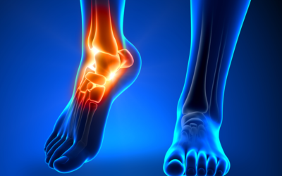 11 Reasons to See a Foot and Ankle Specialist ASAP