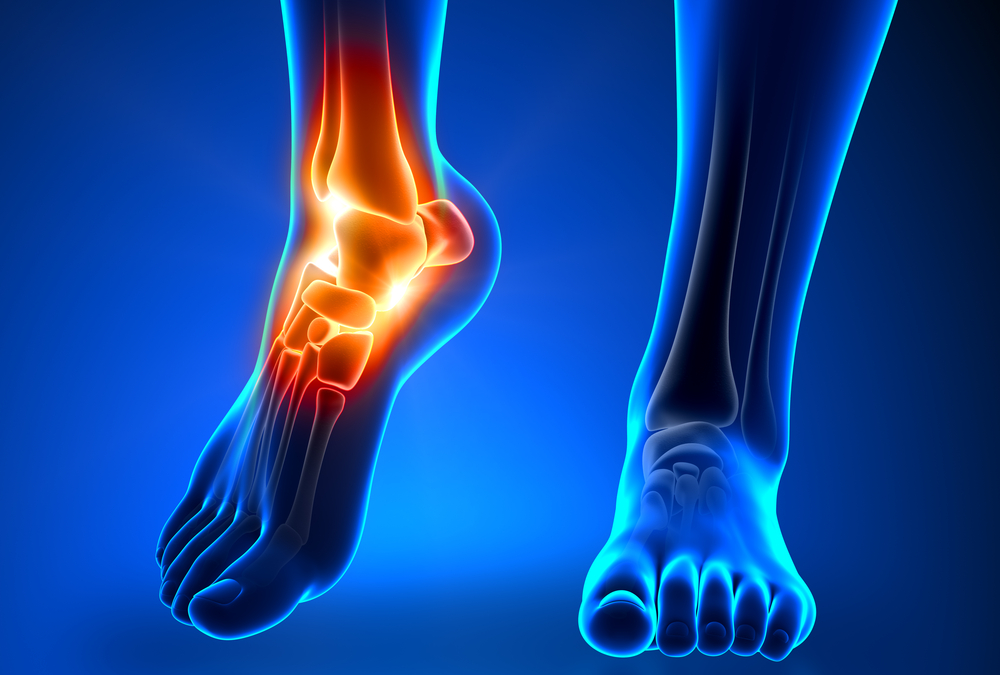 8 Things You Can Do to Relieve Arthritic Ankle Pain